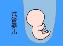 培养昆明捐卵宝宝艺术细胞的小技巧